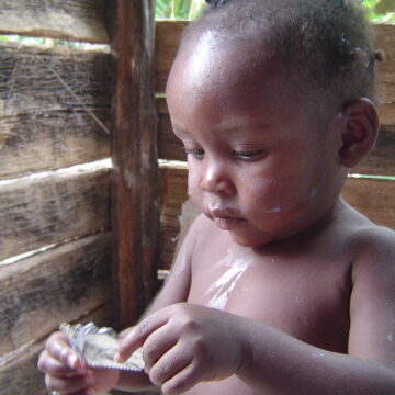 25 de abril: Día mundial de la malaria
