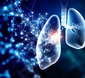La respuesta a la tuberculosis está profundamente afectada por la pandemia COVID – 19
