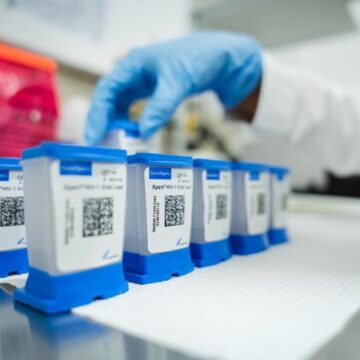 genXpert Las pruebas agrupadas para la tuberculosis funcionan y ahorran dinero