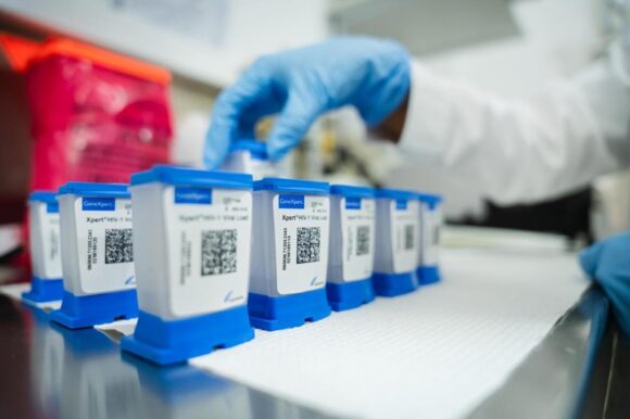 genXpert Las pruebas agrupadas para la tuberculosis funcionan y ahorran dinero